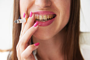 3 Habits Yellowing Your Teeth